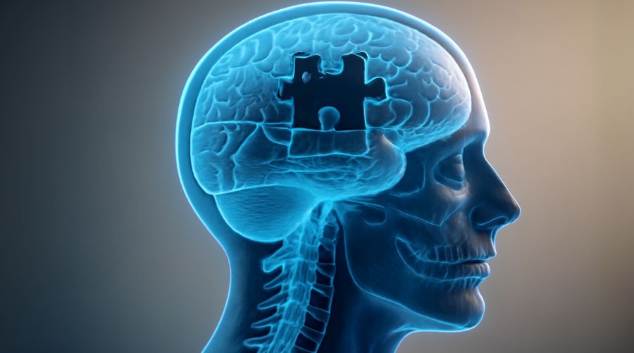 Imagen de IA para el diagnóstico de enfermedades neurodegenerativas